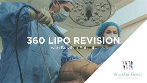 Chevy Chase, MD and lipo 360 with brazilian butt lift, breast surgery. . Dr william rahal 360 lipo cost